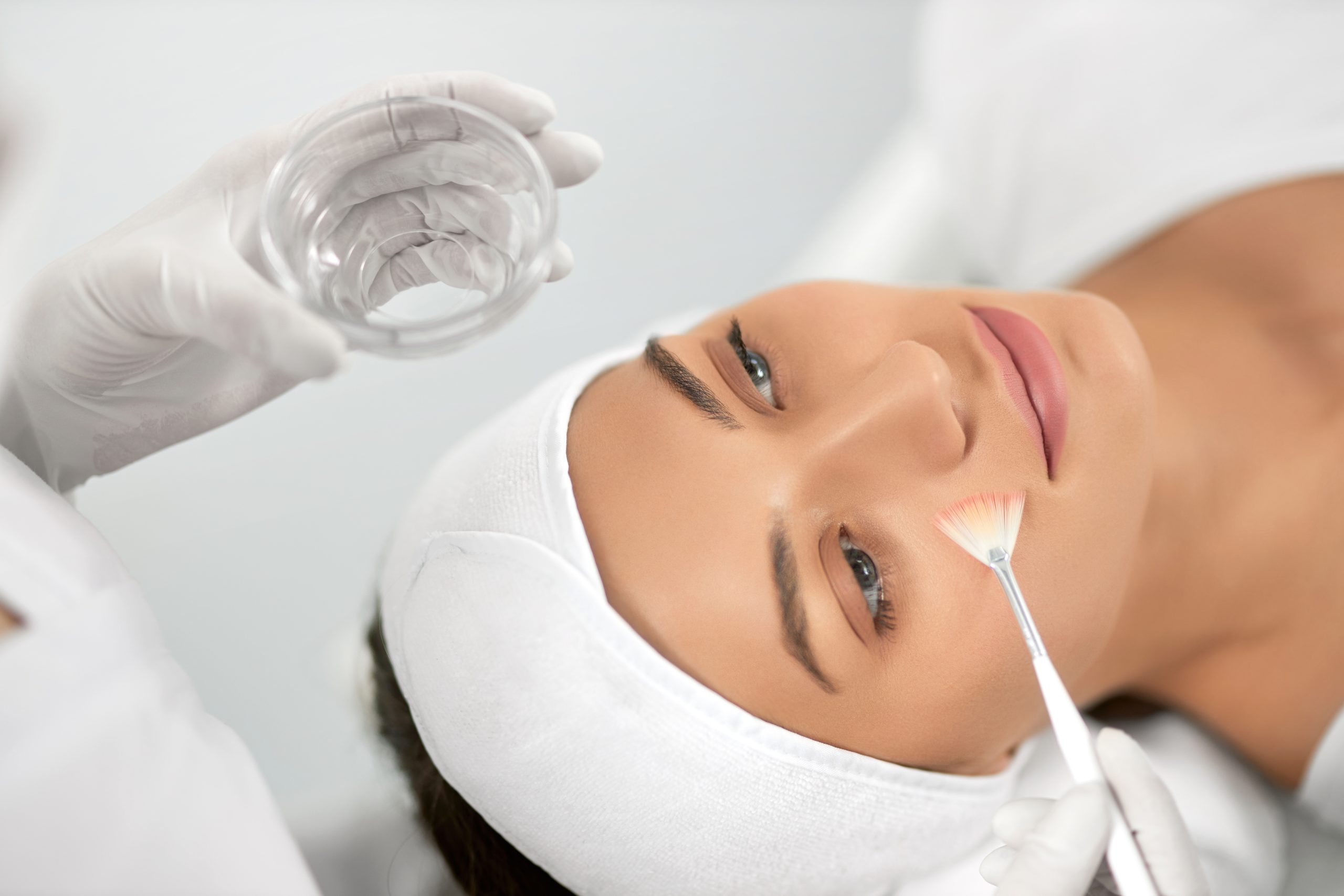 Peeling químico en Madrid realizado por médico especialista en Clínica Marta Prieto