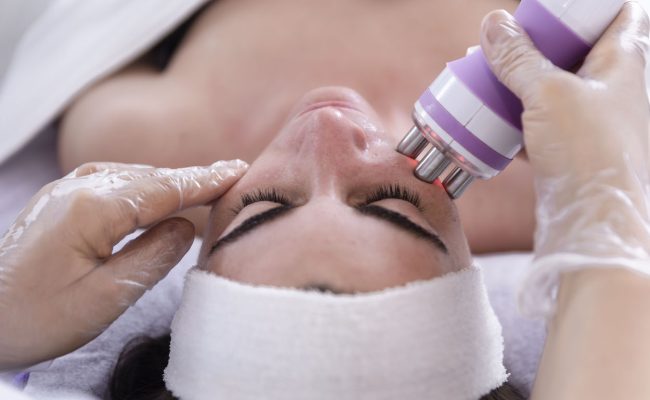 Radiofrecuencia Facial En Madrid